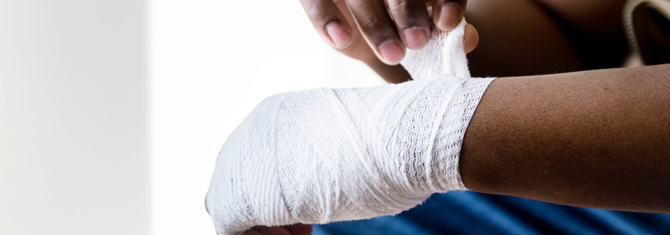 burn victim with bandage on hand