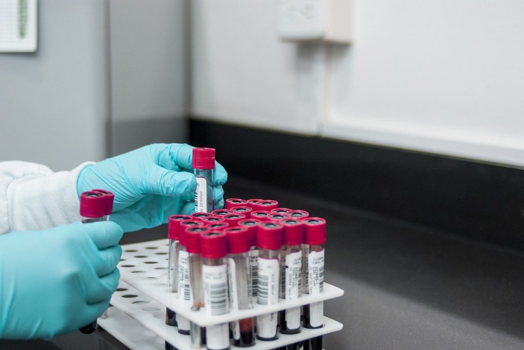 laboratory blood samples
